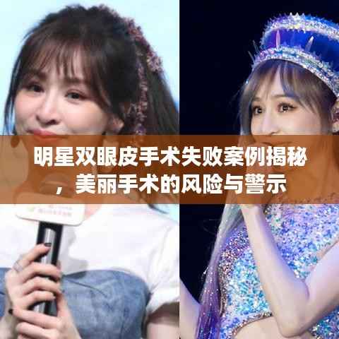 明星双眼皮手术失败案例揭秘,美丽手术的风险与警示