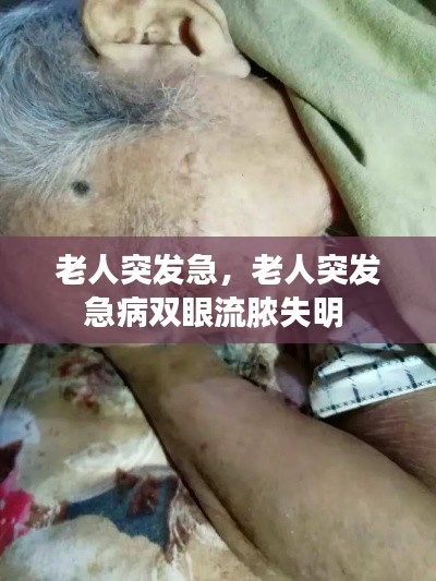 老人突发急,老人突发急病双眼流脓失明