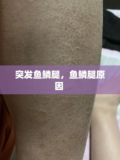 突发鱼鳞腿,鱼鳞腿原因